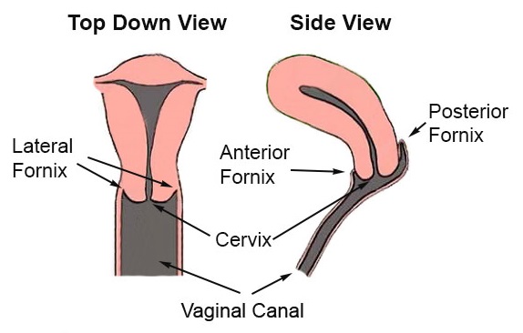 vaginal fornix